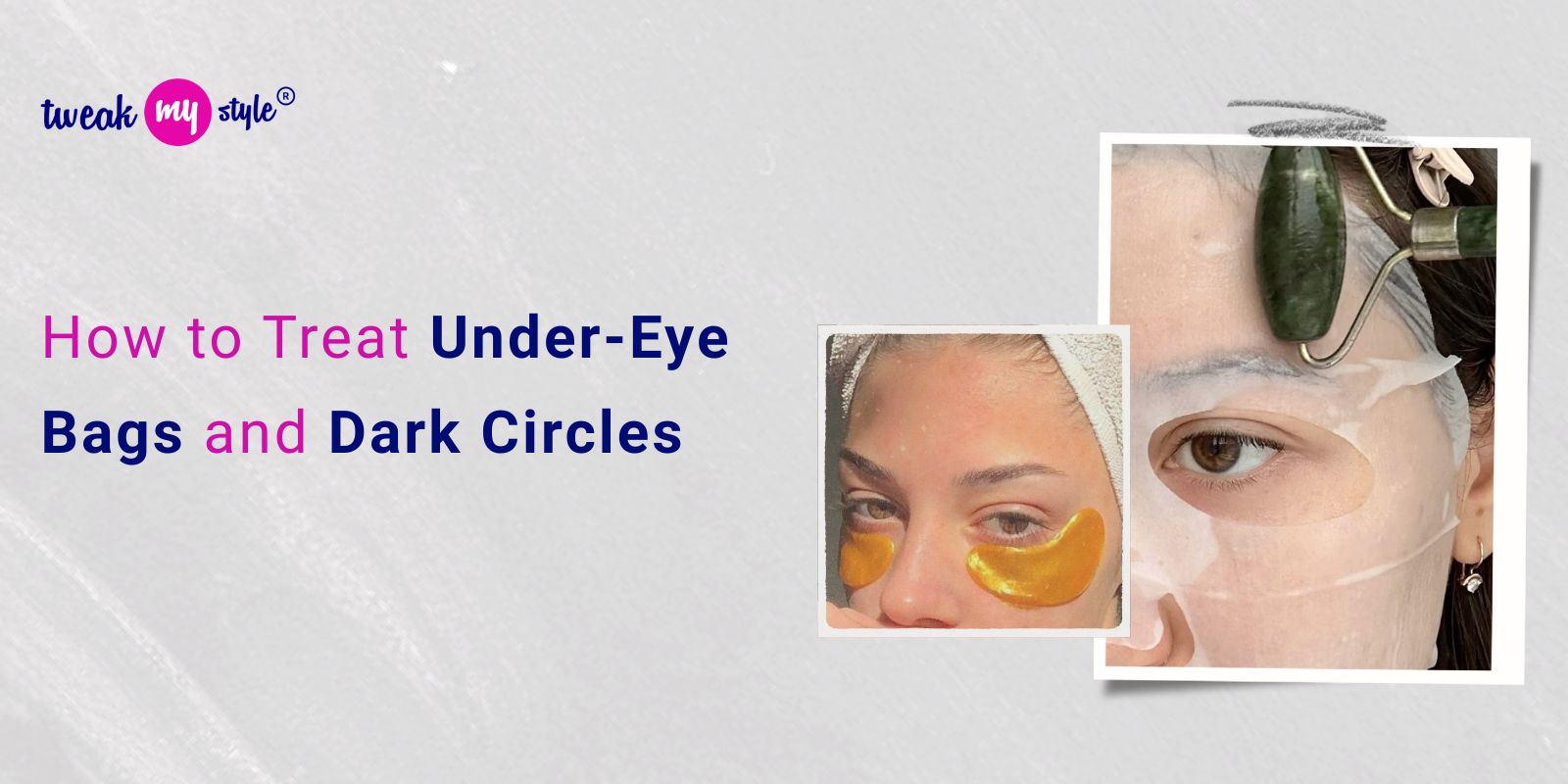 How to Treat Under-Eye Bags and Dark Circles