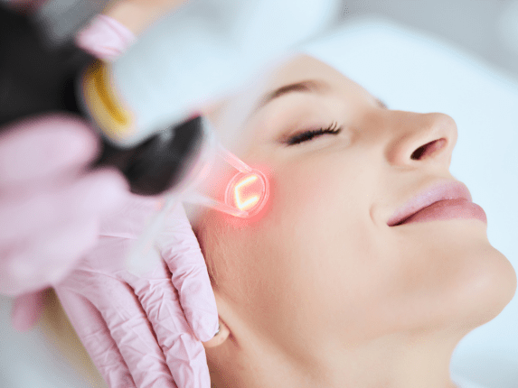 Laser Skin Resurfacing