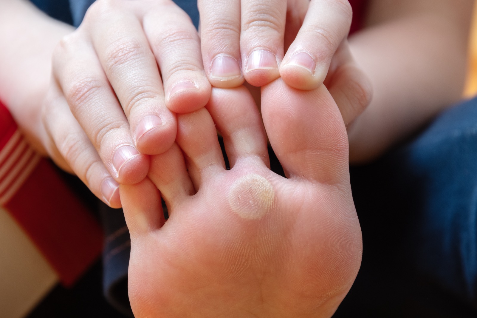 Fungal Infection Treatment