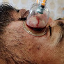 Relax Health Care % Hijama Treatment centre